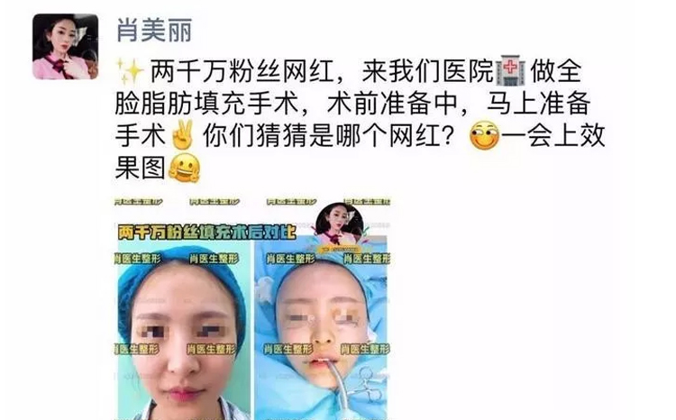 猫妹妹承认做整容手术，下巴变尖，非常后悔